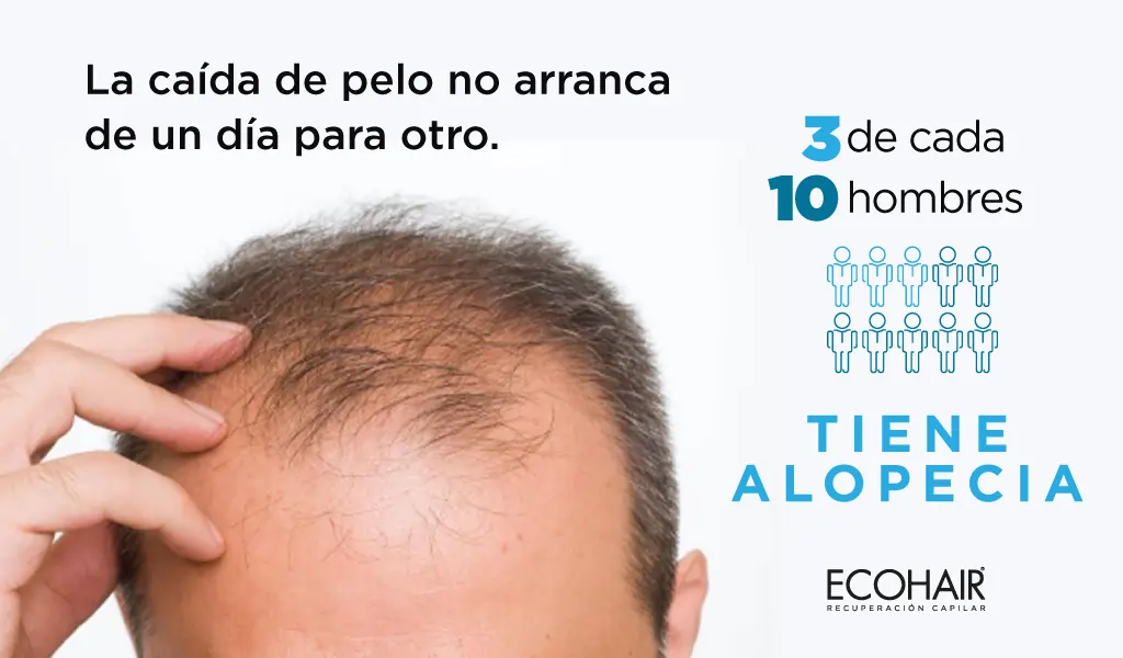 Cuidado capilar en hombres: La caída de pelo no arranca de un día para otro