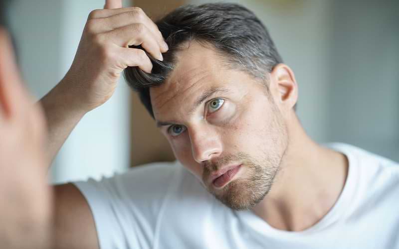 Medicamentos que pueden provocar la caída del cabello y ni te habías enterado