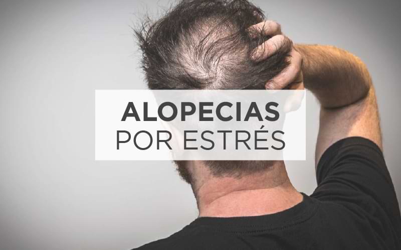 Alopecias por estrés